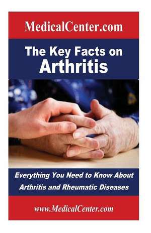 The Key Facts on Arthritis de Patrick W. Nee