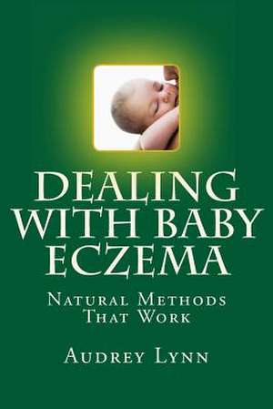 Dealing with Baby Eczema de Audrey Lynn