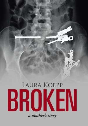 Broken de Laura Koepp