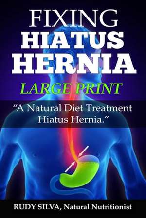 Fixing Hiatus Hernia de Rudy Silva Silva