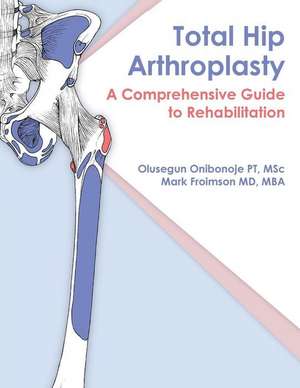 Total Hip Arthroplasty de Olusegun Onibonoje