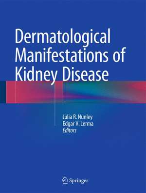 Dermatological Manifestations of Kidney Disease de Julia R. Nunley