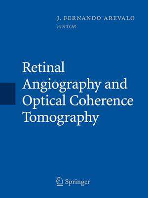 Retinal Angiography and Optical Coherence Tomography de J. Fernando Arévalo