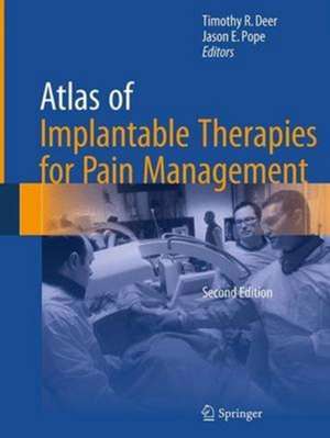 Atlas of Implantable Therapies for Pain Management alte