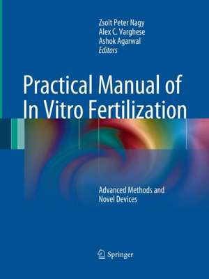 Practical Manual of In Vitro Fertilization: Advanced Methods and Novel Devices de Zsolt Peter Nagy