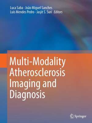 Multi-Modality Atherosclerosis Imaging and Diagnosis de Luca Saba