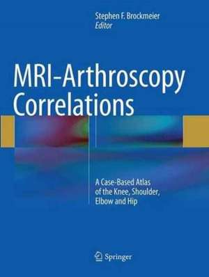 MRI-Arthroscopy Correlations: A Case-Based Atlas of the Knee, Shoulder, Elbow and Hip de Stephen F. Brockmeier