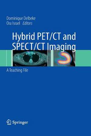 Hybrid PET/CT and SPECT/CT Imaging: A Teaching File de Dominique Delbeke