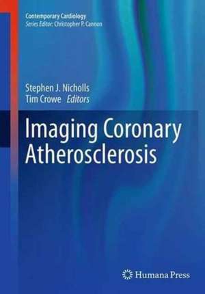 Imaging Coronary Atherosclerosis de Stephen J. Nicholls