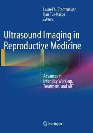 Ultrasound Imaging in Reproductive Medicine: Advances in Infertility Work-up, Treatment, and ART de Laurel Stadtmauer