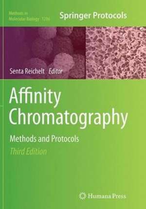 Affinity Chromatography: Methods and Protocols de Senta Reichelt