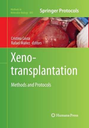 Xenotransplantation: Methods and Protocols de Cristina Costa