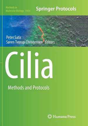 Cilia: Methods and Protocols de Peter Satir