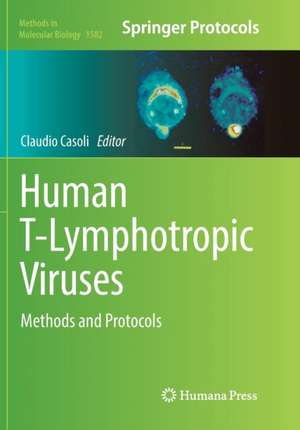 Human T-Lymphotropic Viruses: Methods and Protocols de Claudio Casoli