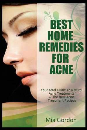 Best Home Remedies for Acne de Mia Gordon