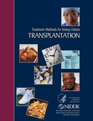 Treatment Methods for Kidney Failure Transplantation de National Institute of Diabetes and Diges