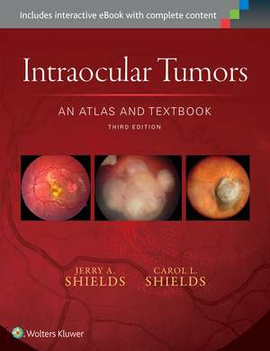 Intraocular Tumors: An Atlas and Textbook de Jerry A. Shields