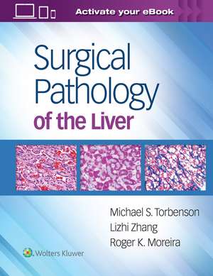 Surgical Pathology of the Liver de Michael Torbenson MD