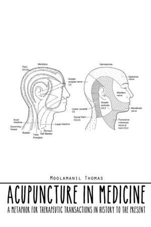 Acupuncture in Medicine de Moolamanil Thomas