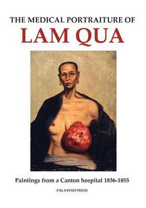 The Medical Portraiture of Lam Qua de Palatino Press