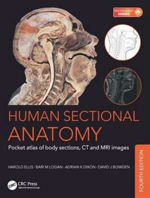 Human Sectional Anatomy: Pocket atlas of body sections, CT and MRI images, Fourth edition de Adrian Kendal Dixon