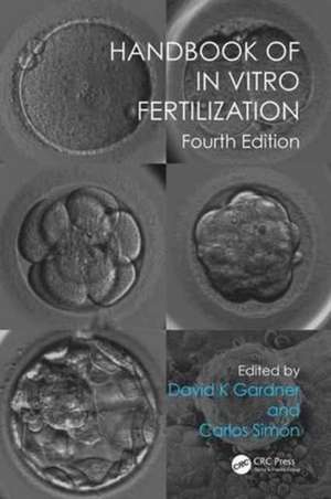 Handbook of In Vitro Fertilization de David K. Gardner