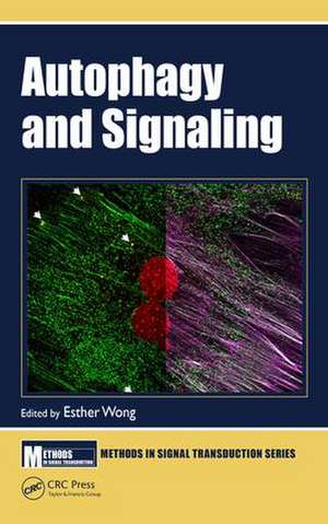 Autophagy and Signaling de Esther Wong