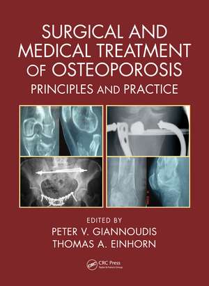 Surgical and Medical Treatment of Osteoporosis: Principles and Practice de Peter V. Giannoudis