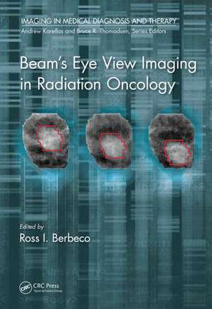 Beam's Eye View Imaging in Radiation Oncology de Ross I. Berbeco