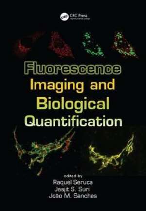 Fluorescence Imaging and Biological Quantification de Raquel Seruca