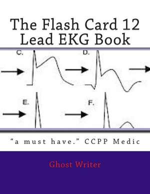 The Flash Card 12 Lead EKG de Ghost Writer