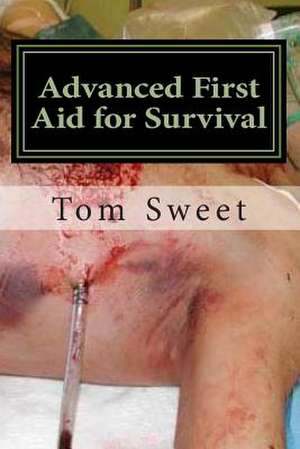 Advanced First Aid for Survival de Tom Sweet