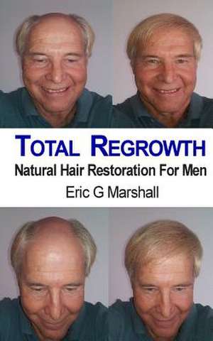 Total Regrowth de MR Eric G. Marshall