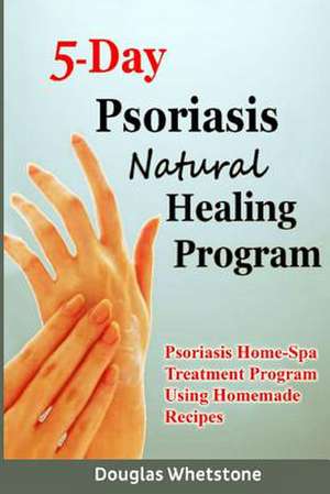 5-Day Psoriasis Natural Healing Program de Douglas Whetstone