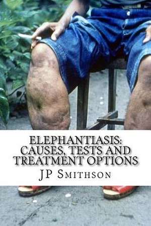 Elephantiasis de Jp Smithson Ma