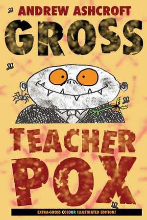 Gross Teacherpox de Andrew Ashcroft