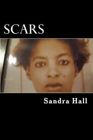 Scars de Sandra a. Hall