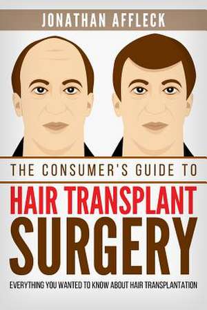 The Consumer's Guide to Hair Transplant Surgery de Jonathan Affleck