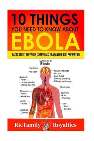 10 Things You Need to Know about Ebola de Rictamily Royalties