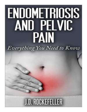 Endometriosis and Pelvic Pain de Rockefeller, J. D.