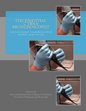 The Essential Ctbna Bronchoscopist de Henri Colt