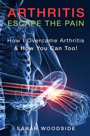 Arthritis de Sarah Woodside