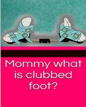 Mommy What Is Clubbed Foot? de Brooke Holey