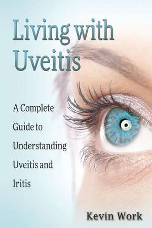 Living with Uveitis: A Complete Guide to Uveitis and Iritis de Kevin Work