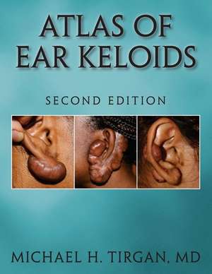 Atlas of Ear Keloids - Second Edition de Michael H. Tirgan MD