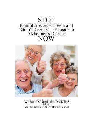 Stop Painful Abscessed Teeth and Gum Disease That Leads to Alzheimer's Now. de Dr William D. Nordquist DMD MS