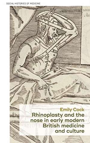 Rhinoplasty and the Nose in Early Modern British Medicine and Culture de Emily Cock