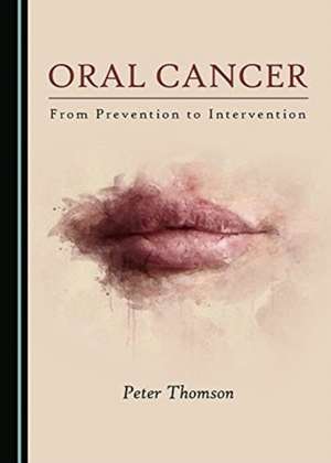 Oral Cancer de Peter Thomson