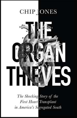 The Organ Thieves de Chip Jones