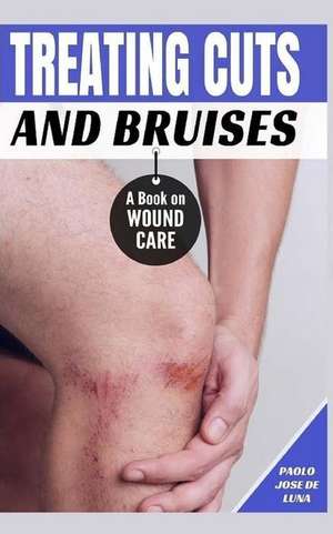 Treating Cuts and Bruises de Paolo Jose De Luna